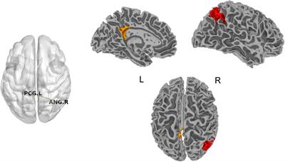 Frontiers | Acupuncture Treatment Decreased Temporal Variability Of ...